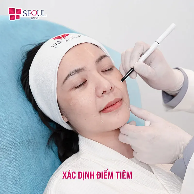 Bác sĩ xác định điểm tiêm trước khi tiến hành tiêm Trẻ Hóa Neo Doublyx Evo