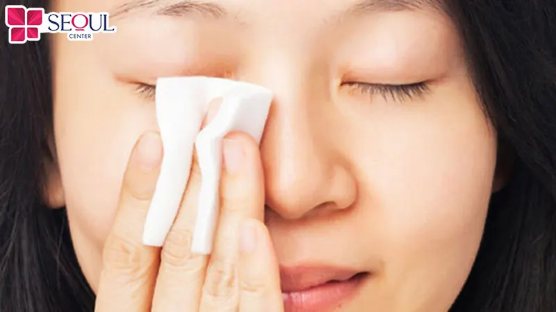 Vệ sinh da cẩn thận bằng cách dùng bông tẩy trang thấm nước muối sinh lý lau toàn mặt nhẹ nhàng