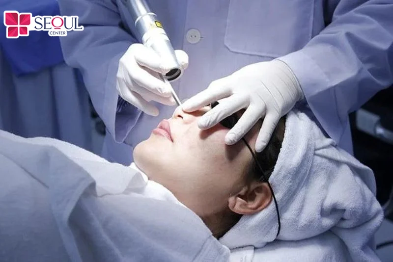 Phương pháp chiếu ánh sáng vi điểm tác động sâu vào tuyến bã nhờn giúp làm mờ mụn