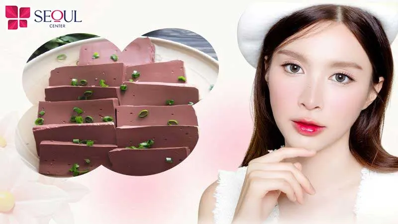 Bạn nên ăn tiết lợn luộc chín kỹ và vệ sinh môi sạch sẽ bằng nước muối sinh lý sau khi ăn