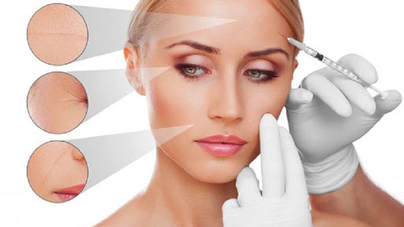 3 vùng thường tiêm filler để trẻ hóa: trán, hốc mắt, má 3 vùng thường tiêm filler để trẻ hóa: trán, hốc mắt, má