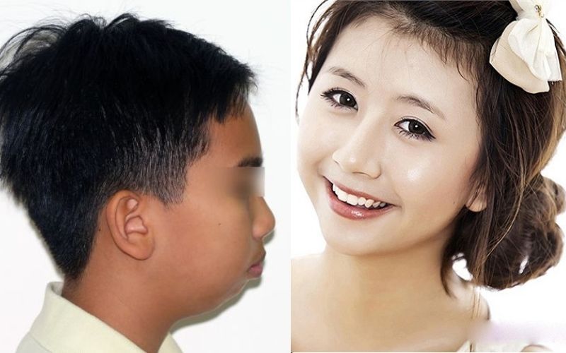 Tướng phụ nữ, đàn ông cằm ngắn có vận mệnh không tốt Tướng phụ nữ, đàn ông cằm ngắn có vận mệnh không tốt