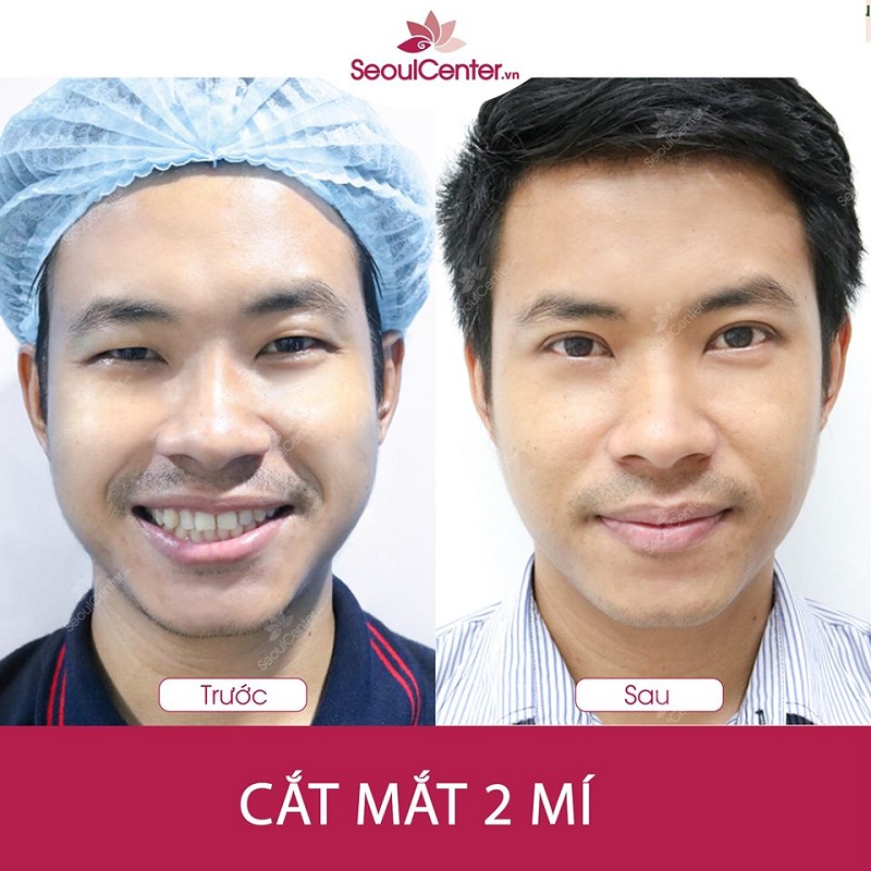 Anh Nam Huy (32 tuổi, TP.HCM)