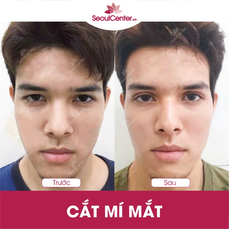 Anh Chí Cường (26 tuổi, TP.HCM)