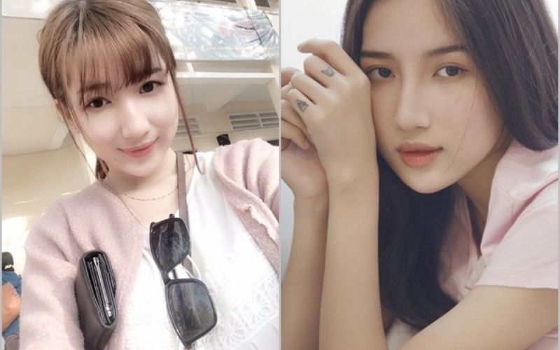 Bạn gái “lên đời” nhan sắc nhờ tiêm filler cằm, mũi, má và thon gọn hàm