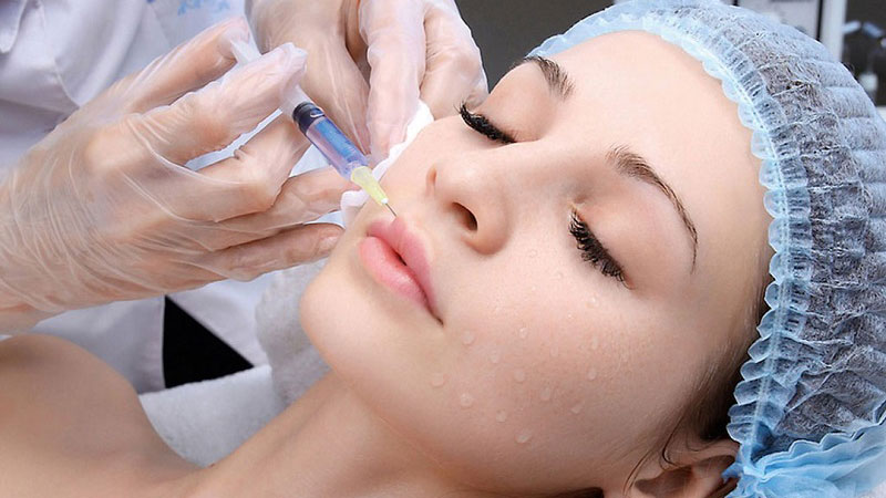 Hình ảnh minh họa ca tiêm filler môi Hình ảnh minh họa cho ca tiêm môi