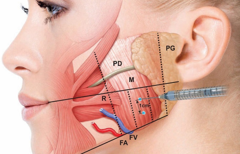 Bác sĩ chuyên khoa cần thực hiện đúng những chỗ cần tác động