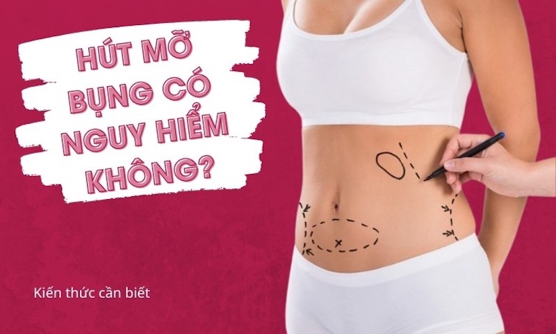 Hút mỡ bụng có nguy hiểm không?