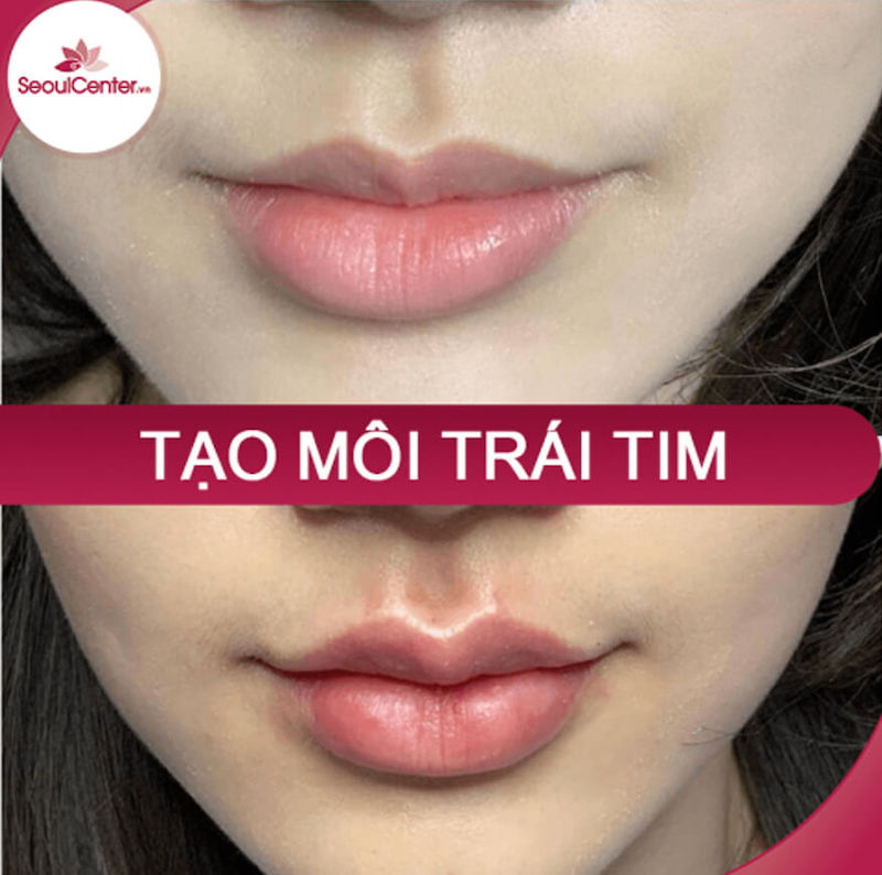 Khách hàng sử dụng dịch vụ tạo hình môi trái tim tại Seoul Center