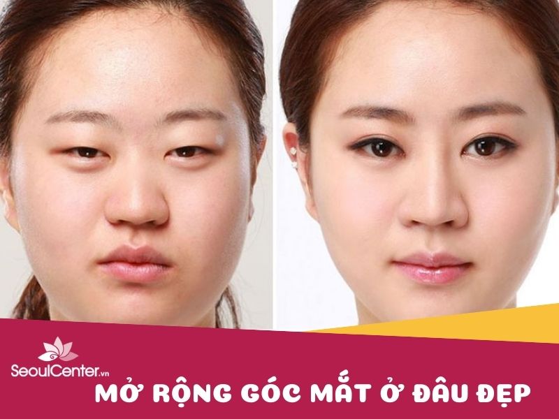 Nhu cầu tìm kiếm địa chỉ mở góc mắt đẹp tại TP. Hồ Chí Minh rất lớn