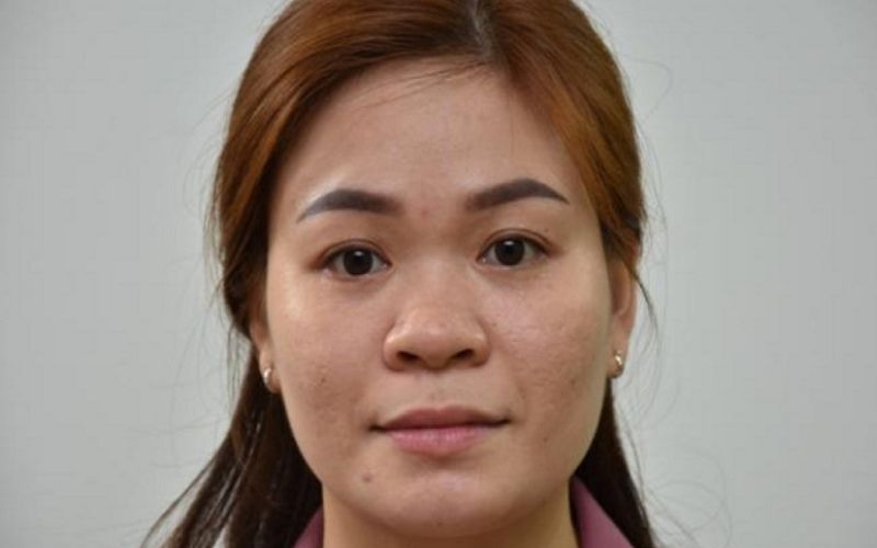 Nên chỉnh sửa dáng mũi thấp tẹt để giúp khuôn mặt có đường nét thanh tú hơn