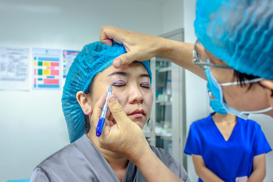 Tiến hành tiểu phẫu nâng cung chân mày nội soi trong vòng 30 - 45 phút Tiến hành tiểu phẫu nâng cung chân mày nội soi trong vòng 30 - 45 phút