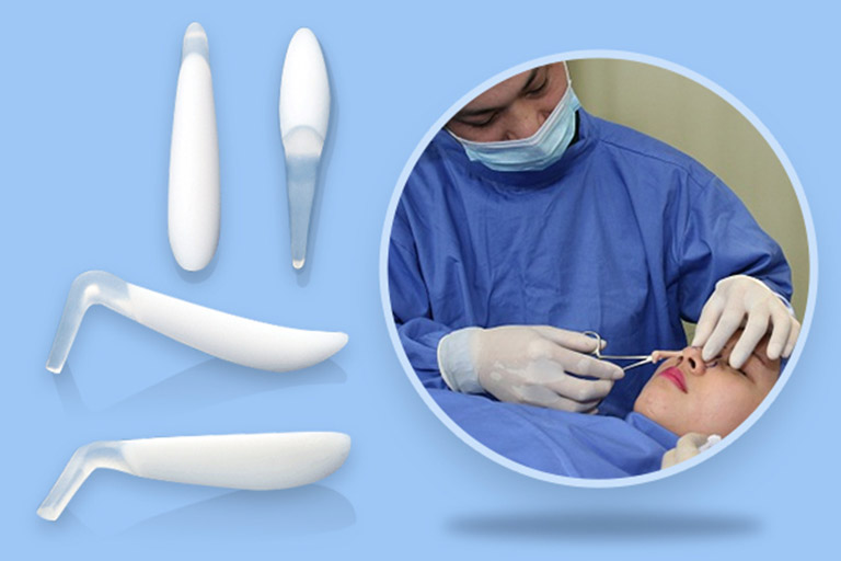Quy trình thực hiện đơn giản, nhanh chóng và vết thương không quá lớn