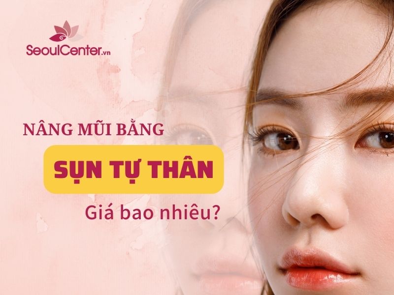 Nâng mũi sử dụng chất liệu sụn tự thân mang đến nhiều ưu điểm nổi bật cho khách hàng