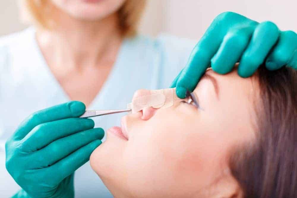Sử dụng sụn Surgiform được cấu tạo từ vật liệu ePTFE cao cấp để nâng mũi