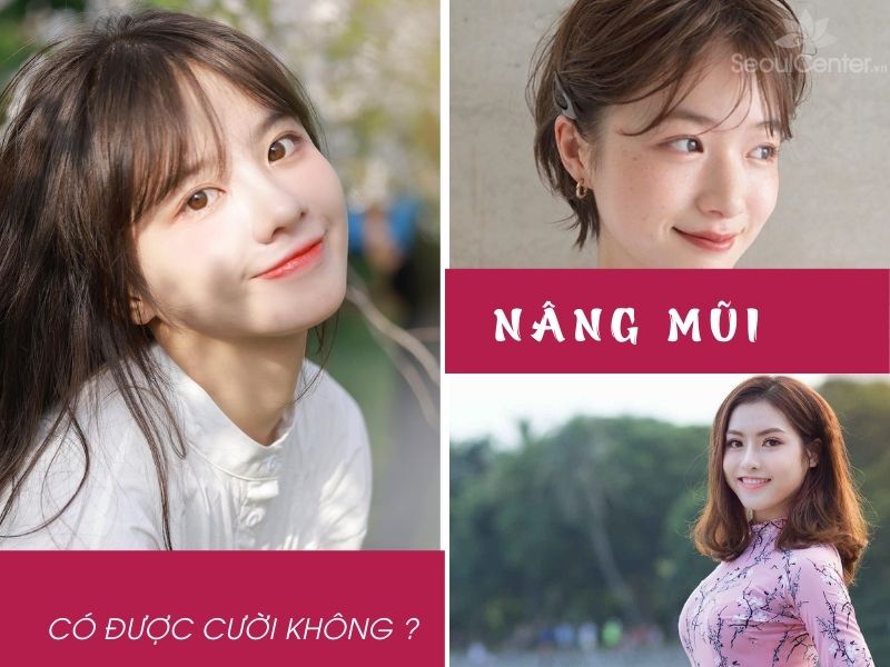 Nâng mũi xong có được cười hay không là vấn đề rất được quan tâm