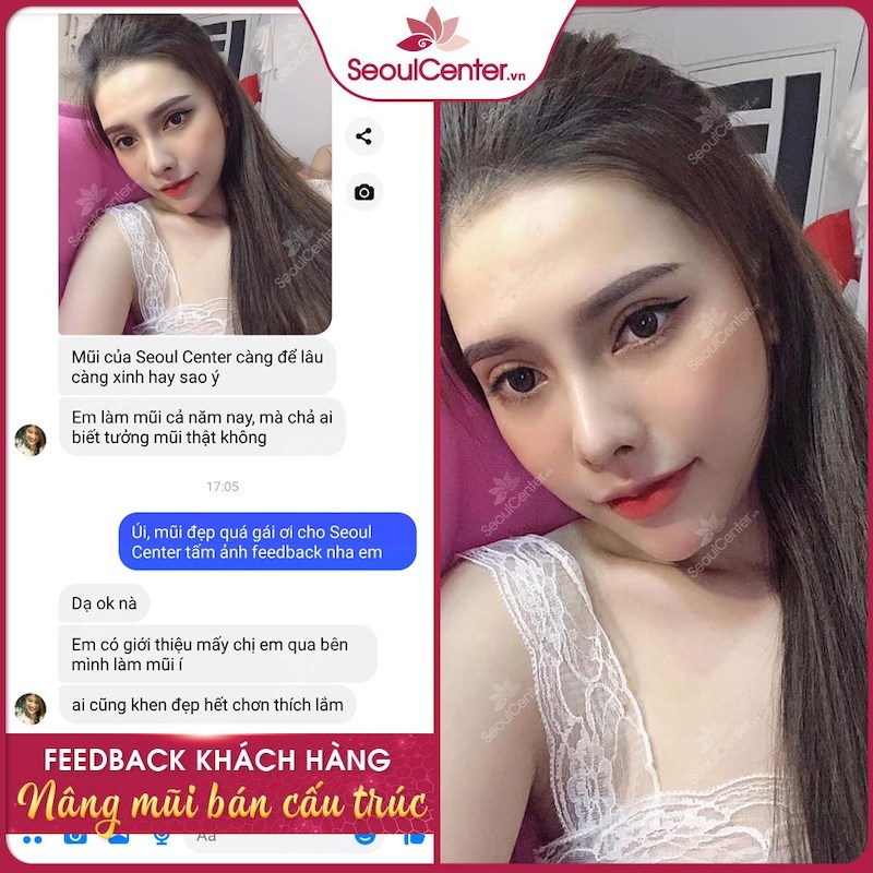 Feedback tích cực của khách hàng về dịch vụ nâng mũi của Seoul Center