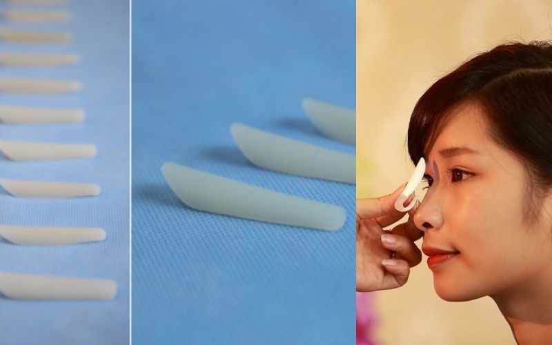 Chất liệu sụn nâng được điêu khắc phù hợp với khuôn mặt khách hàng