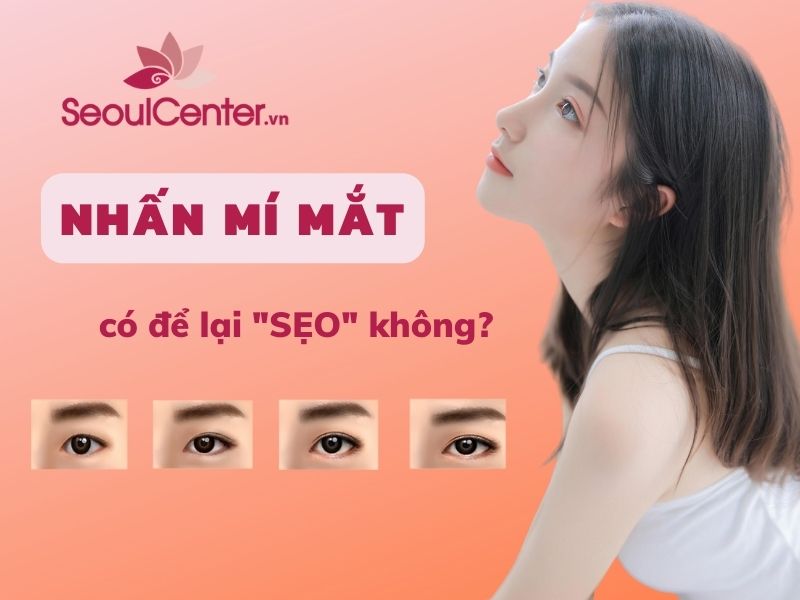 Nhấn mí không để lại sẹo nếu lựa chọn bác sĩ chất lượng