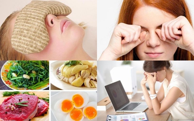 Những điều nên và không nên thực hiện sau khi cắt mí