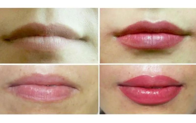 Kết quả phun môi sau 1 tháng, màu sắc tươi tắn hơn Kết quả phun môi sau 1 tháng, màu sắc tươi tắn hơn