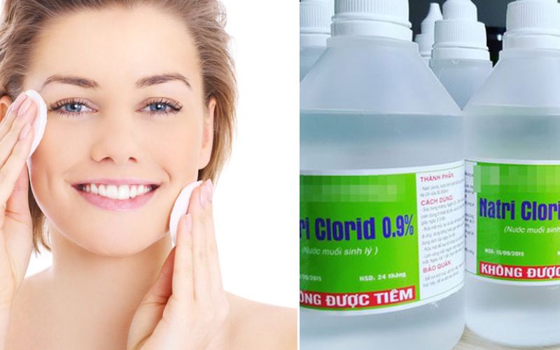 Vệ sinh môi bằng nước muối sinh lý mỗi ngày 2 lần để môi luôn sạch sẽ, tránh viêm nhiễm Vệ sinh môi bằng nước muối sinh lý mỗi ngày 2 lần để môi luôn sạch sẽ, tránh viêm nhiễm