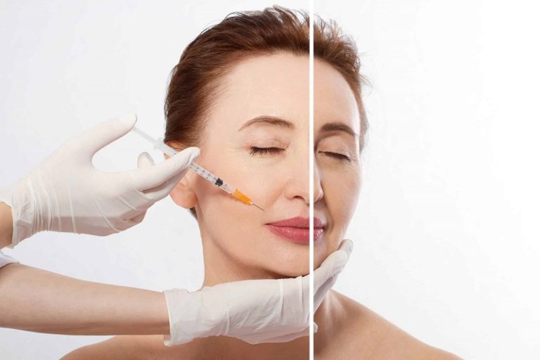 Tiêm botox giá bao nhiêu còn tùy thuộc vào nhiều yếu tố