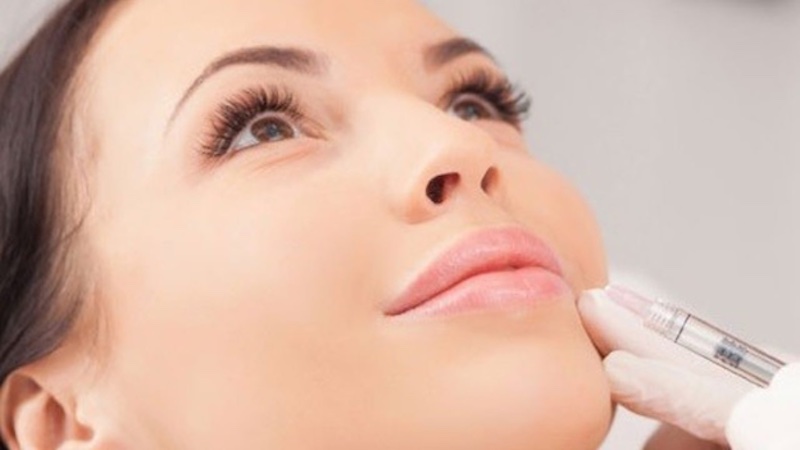 Tiêm filler cằm có mức giá trung bình khoảng 8.000.000 đồng