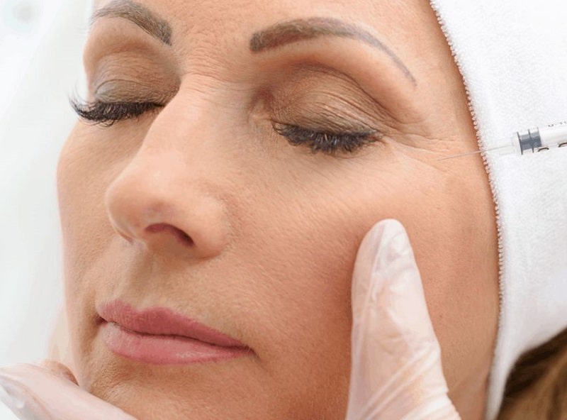 Nhiều khách hàng lựa chọn tiêm filler thái dương để có được kết quả như mong muốn