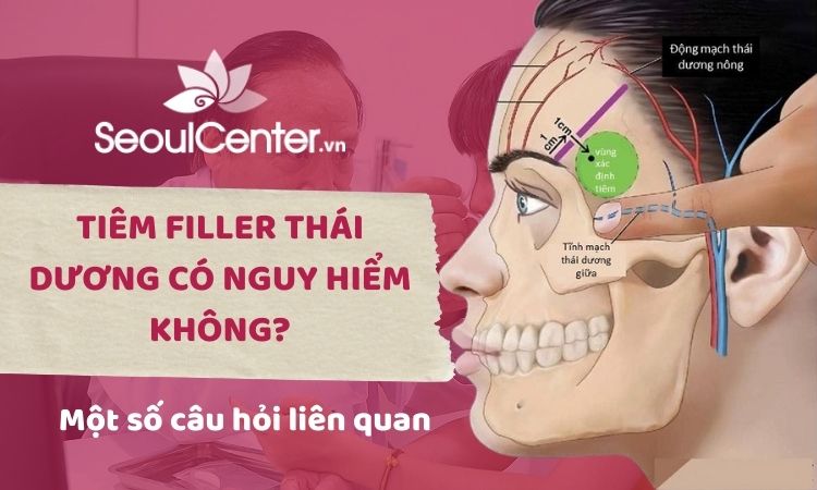 Phương pháp tiêm Filler thái dương có nguy hiểm không?