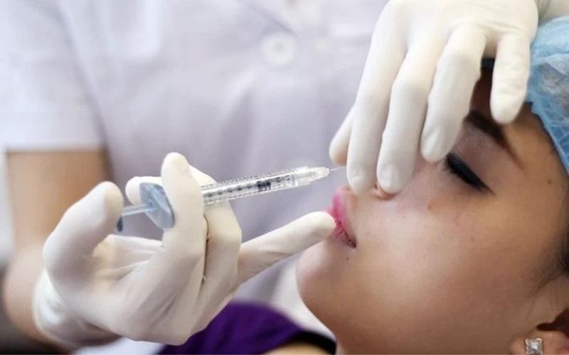 Filler giúp làm bằng phẳng vết lõm và còn trẻ hóa vùng da