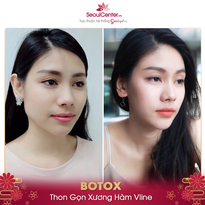 Chăm sóc đúng cách giúp duy trì hiệu quả làm đẹp lâu dài hơn