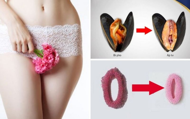 Cần trẻ hóa vùng kín tại những cơ sở uy tín mới loại bỏ được mọi khuyết điểm