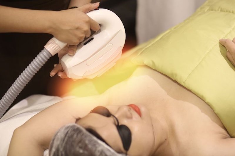 Chi phí trị thâm nách phụ thuộc vào phương pháp bạn sử dụng