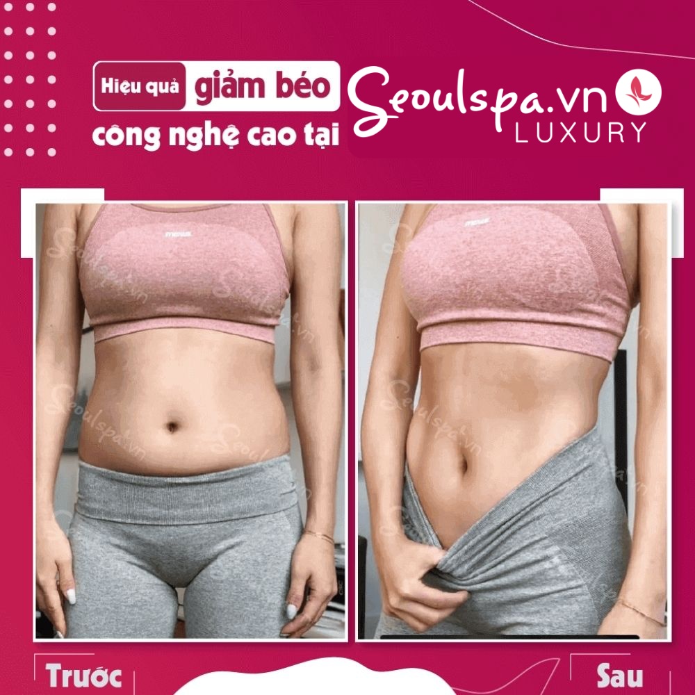 Giá cả phù hợp – Giảm béo hiệu quả cao