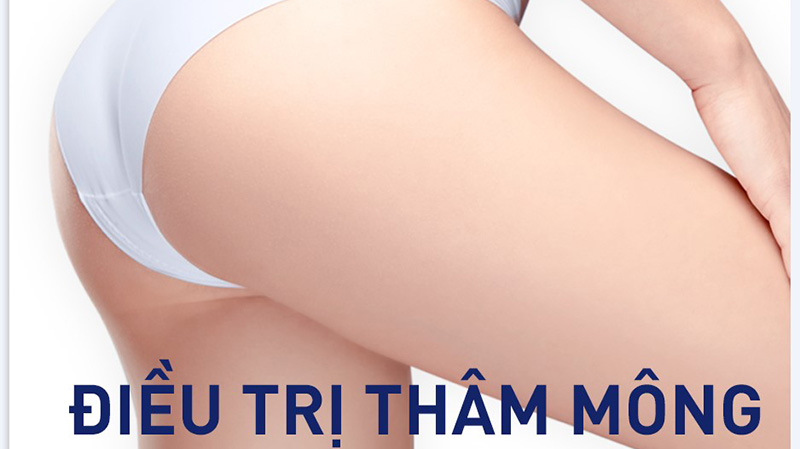 SeoulLuxury.vn áp dụng công nghệ hiện đai vào trị thâm mông