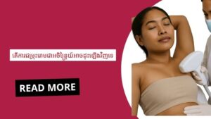 ការចាក់_ថ្នាំ_សម្រក_ខ្លាញ់_ក្បាល_ពោះអាចរក្សាប្រសិទ្ធិភាពយូរ_ដែរ_ទេ (1)