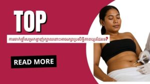 ការចាក់_ថ្នាំ_សម្រក_ខ្លាញ់_ក្បាល_ពោះអាចរក្សាប្រសិទ្ធិភាពយូរ_ដែរ_ទេ