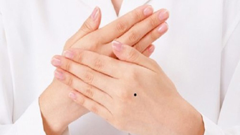 Nốt ruồi ở tay phải 6 Nốt ruồi son ở tay trái