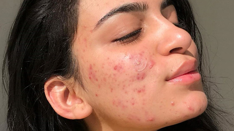 Gây mất thẩm mỹ trầm trọng
