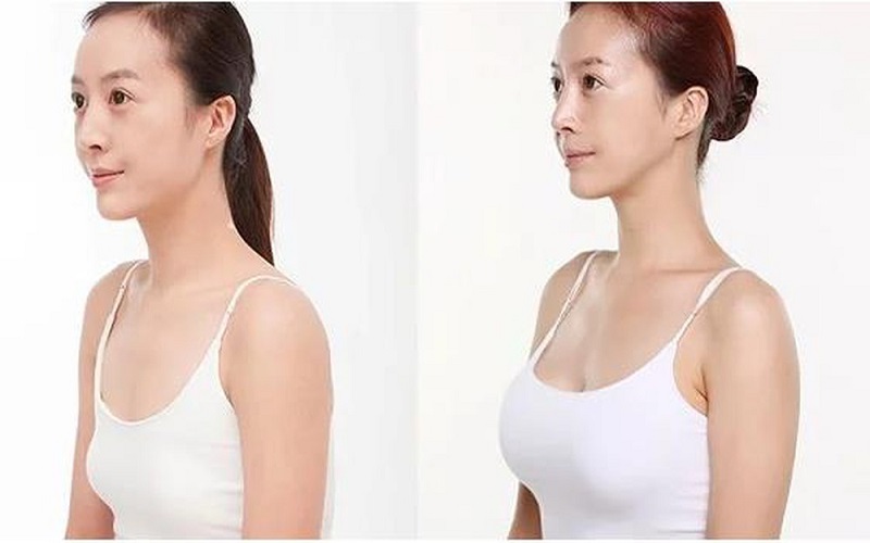 Từ 16 - 18 tuổi kích thước vòng 1 sẽ phát triển nhanh chóng