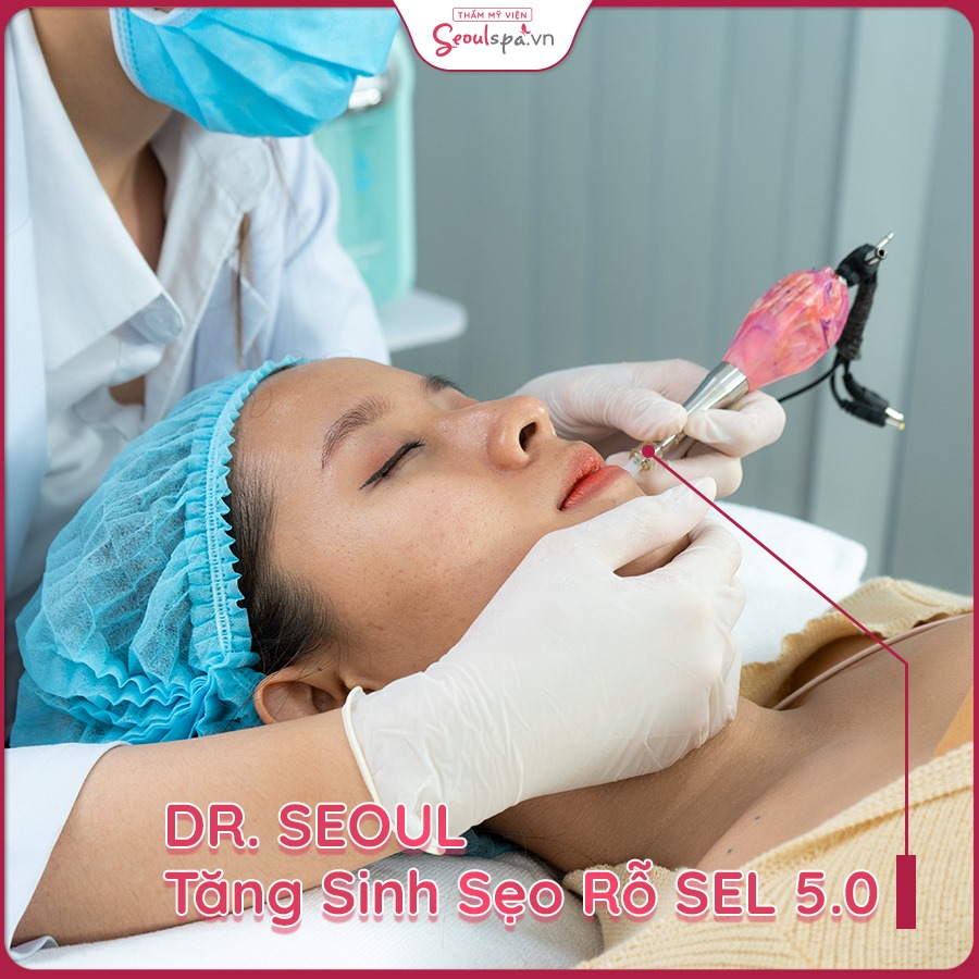 Loại bỏ sẹo rỗ với Dr. Seoul Tăng Sinh sẹo rỗ SEL 5.0