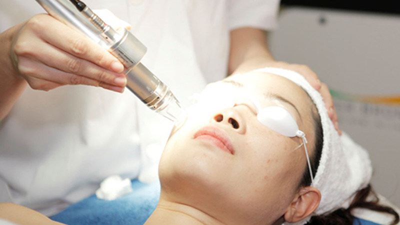 Trị sẹo tạo spa