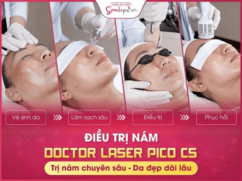 Phương pháp giải quyết dứt điểm nám da bằng Doctor Laser Pico