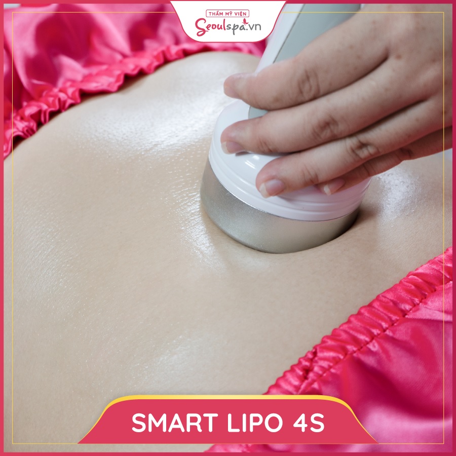 Giảm cân bằng phương pháp Smarrt Lipo 4S