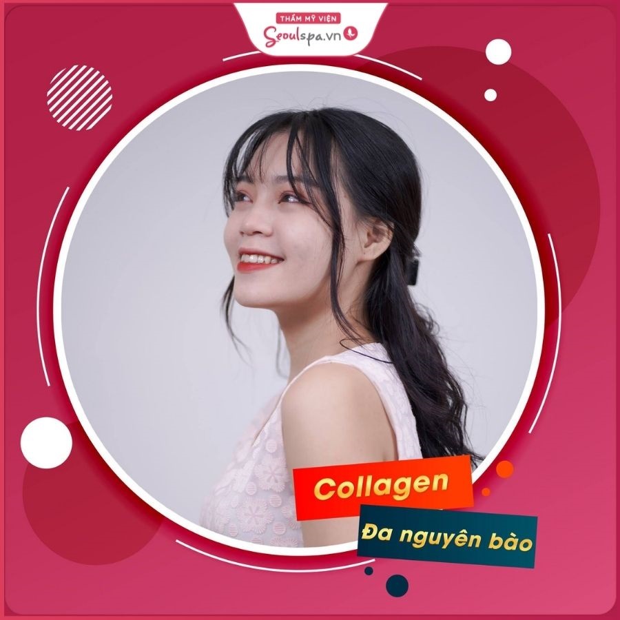 Cấy collagen đa nguyên bào hoàn thiện gương mặt hài hòa trẻ trung hơn