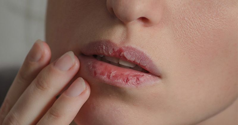 Khử phun môi còn tăng thêm màu môi cho các khách hàng