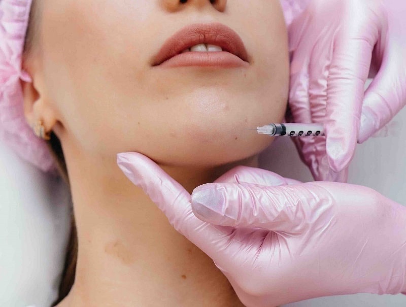 Bác sĩ tiêm Filler tạo dáng cằm V-line không phẫu thuật cho khách hàng