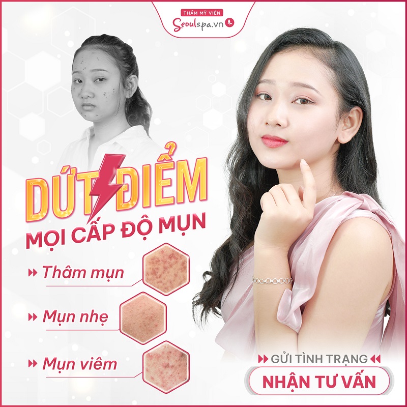 Công nghệ điều trị mụn tại Seoul Spa an toàn và hiệu quả cao