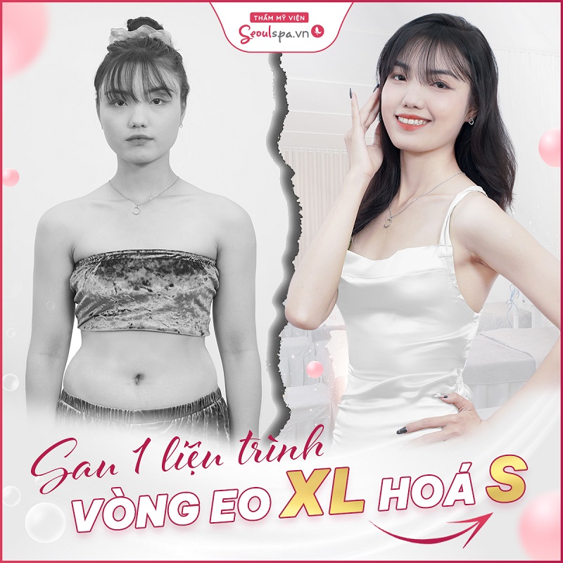 Top 20+ Một Cái Bánh Chocopie Bao Nhiêu Calo 1 bánh Chocopie bao nhiêu calo? Cách ăn Chocopie không béo 36 Công nghệ giảm béo E-Sonic phù hợp với mọi đối tượng trên 18 tuổi